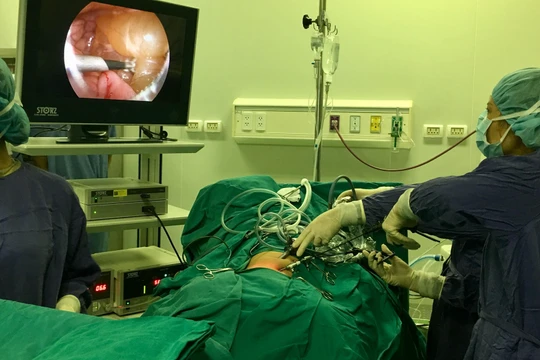 Nhóm bác sĩ của Bệnh viện phẫu thuật nội soi cắt khối u cho Đ.