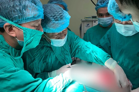 Các bác sĩ phẫu thuật loại bỏ khối u to cho bà V.