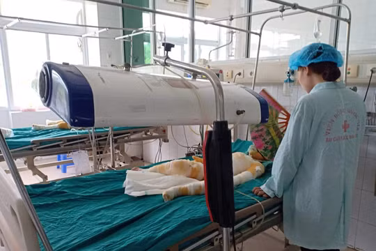 Người nhà bệnh nhi chăm sóc cho một trong 3 em bé ở Hà Nam bị bỏng.