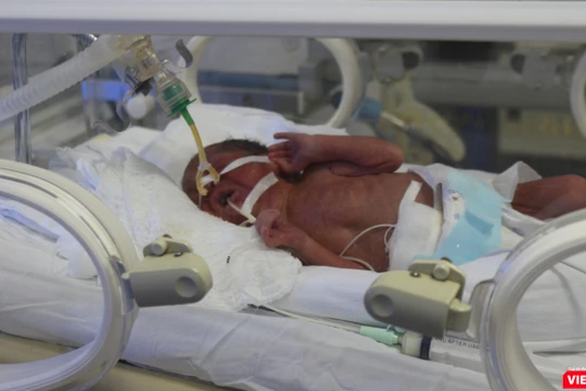 Em bé Bình An đang được điều trị tích cực tại Bệnh viện Phụ sản Trung ương sáng 24/5.