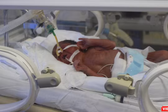 Em bé Bình An đang được điều trị tích cực tại Bệnh viện Phụ sản Trung ương sáng 24/5.