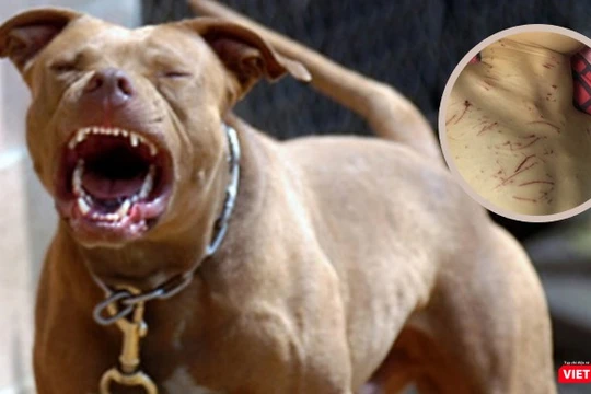Nhiều vụ chó nhà cắn trẻ gây tổn thương nặng vẫn thường xuyên xảy ra