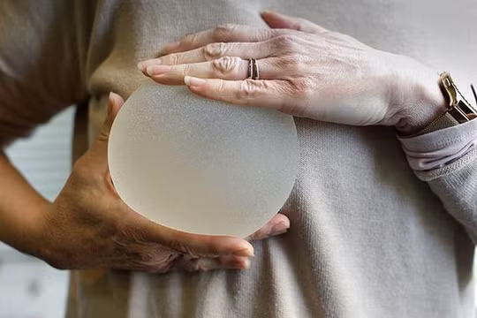 Túi nâng ngực có độ bền chắc, không bị vỡ vì áp suất trên máy bay (Ảnh: Getty Images)