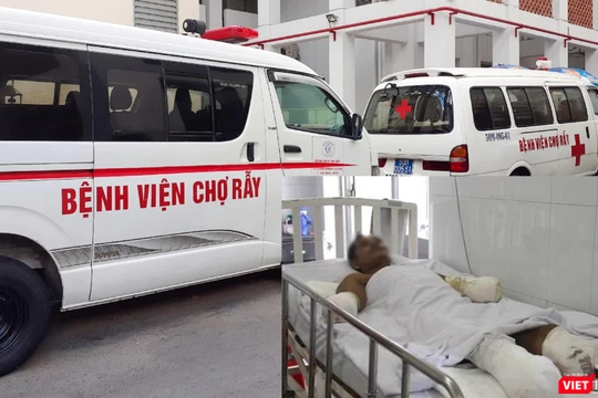 Bệnh nhân bị phỏng điện đang điều trị tại Bệnh viện Chợ Rẫy 