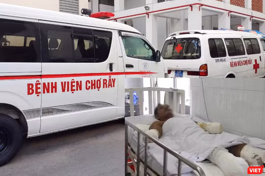 Bệnh nhân bị phỏng điện đang điều trị tại Bệnh viện Chợ Rẫy 