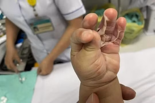 Chị H. cho rằng bác sĩ của Bệnh viện FV kê sai đơn thuốc khiến vết bỏng của con trai chị trở nặng - Ảnh: Chị H. cung cấp