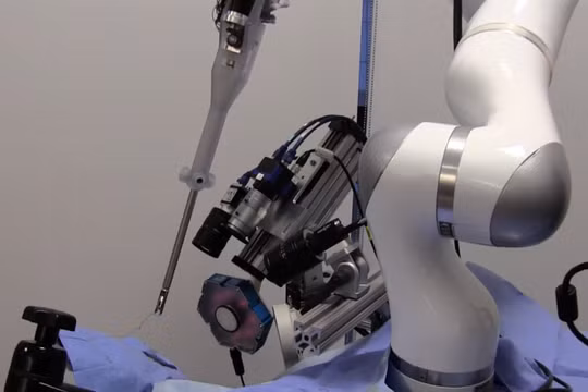 Robot đang chứng tỏ khả năng phẫu thuật tài tình (ảnh: BGR)