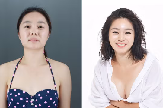 Người Hàn Quốc có quan niệm rắt cởi mở về phẫu thuật thẩm mỹ. Nguồn: Business Insider