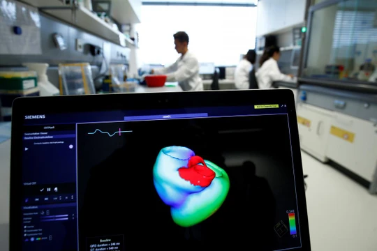 Một màn hình hiển thị hình ảnh ba chiều về trái tim con người tại Viện Tim mạch tính toán tích hợp Klaus-Tschira, khoa Bệnh viện Đại học Heidelberg (Universitaetsklinikum Heidelberg), tại Heidelberg, Đức, ngày 14/8/2018. Ảnh: REUTERS