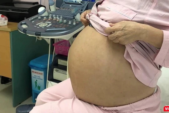 Bệnh nhân M. trước khi phẫu thuật