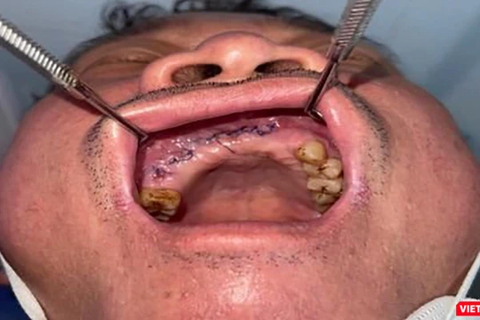 Bệnh nhân sau khi được phẫu thuật điều trị (ảnh bệnh viện cung cấp)