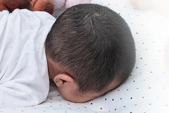 Cảnh báo hội chứng đột tử ở trẻ nhỏ (ảnh bệnh viện cung cấp)