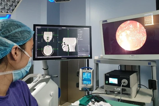 Các bác sĩ của Bệnh viện Trung ương Quân đội 108 phẫu thuật loại bỏ khối u cho bệnh nhân (Ảnh - BVCC) 