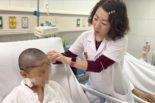 Bác sĩ kiểm tra vết thương cho bé gái bị lột da đầu, lộ xương sọ do tóc cuốn và bánh xe (Ảnh: BVCC) 