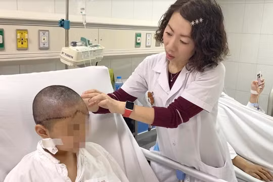 Bác sĩ kiểm tra vết thương cho bé gái bị lột da đầu, lộ xương sọ do tóc cuốn và bánh xe (Ảnh: BVCC) 