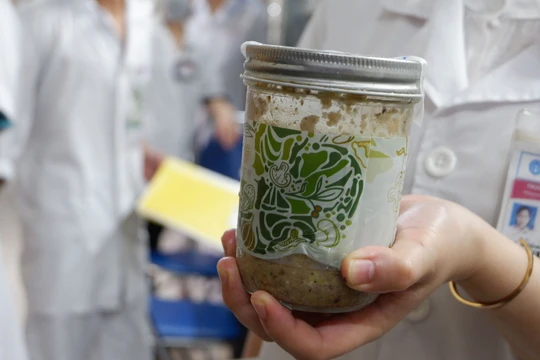 Bộ Công an đang tiến hành điều tra về vụ ngộ độc pate Minh Chay. Ảnh: Lê Minh 