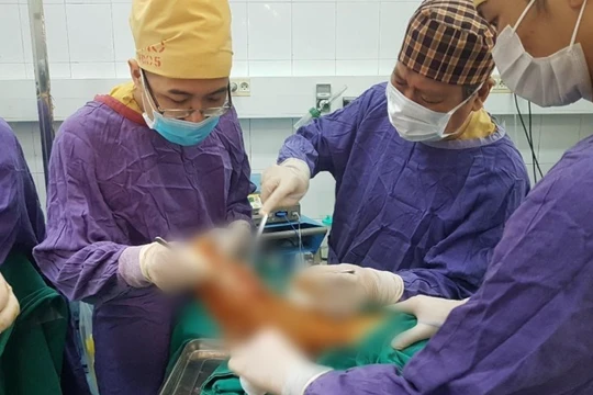 Các bác sĩ phẫu thuật cho bệnh nhân (Ảnh - BVCC) 