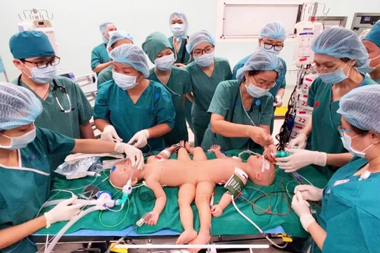Gần 100 y, bác sĩ đang tiến hành phẫu thuật tách rời cặp song sinh Trúc Nhi – Diệu Nhi (Ảnh: Bệnh viện Nhi đồng Thành phố - TP. Hồ Chí Minh)