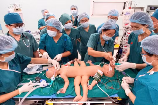 Gần 100 y, bác sĩ đang tiến hành phẫu thuật tách rời cặp song sinh Trúc Nhi – Diệu Nhi (Ảnh: Bệnh viện Nhi đồng Thành phố - TP. Hồ Chí Minh)