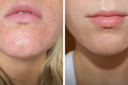 Rửa mặt ít nhất 60 giây giúp chị em có một làn da trắng mịn (Ảnh: Brightside) 