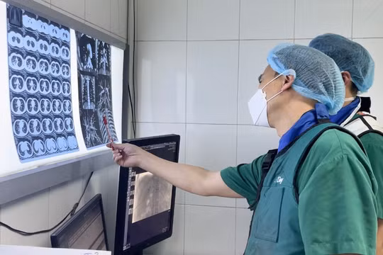 TS.BS Lê Thanh Dũng – Trưởng Trưởng khoa Chẩn đoán hình ảnh, Bệnh viện Hữu nghị Việt Đức đang hội chẩn can thiệp cấp cứu cho BN Đ. (Ảnh - BVCC)