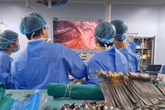 Các bác sĩ thực hiện thành công kĩ thuật phẫu thuật nội soi lấy mảnh ghép gan phải từ người hiến sống để ghép gan cho bệnh nhân (Ảnh - BVCC)