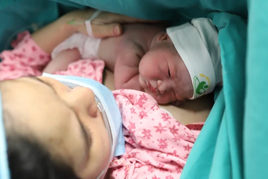 Bé gái chào đời khoẻ mạnh khi mẹ có nhiều bệnh lý phức tạp (Ảnh - BVCC) 