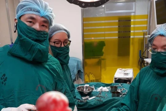 Bác sĩ cắt bỏ khối u xơ (Ảnh: BVCC) 