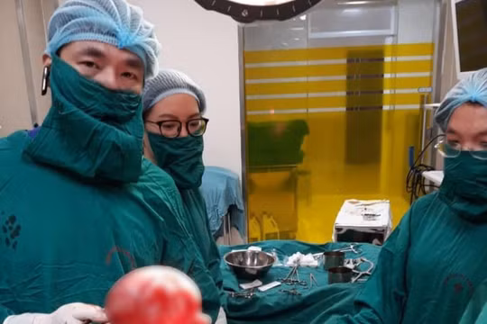 Bác sĩ cắt bỏ khối u xơ (Ảnh: BVCC) 