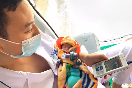 Bé sinh non 29 tuần được bác sĩ tại Bệnh viện Sản nhi Quảng Ninh chăm sóc (Ảnh: BVCC) 