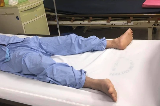 Bệnh nhân tự bẻ cong dương vật đã bình phục sau mổ (Ảnh: BVCC) 