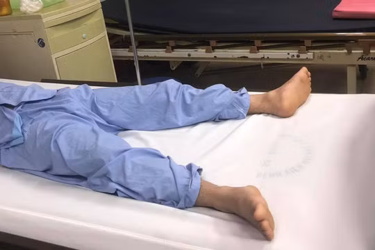 Bệnh nhân tự bẻ cong dương vật đã bình phục sau mổ (Ảnh: BVCC) 