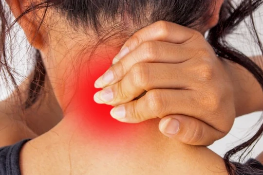 Dân văn phòng thường xuyên bị đau cổ vì thói quen làm việc (Ảnh: BrightSide)