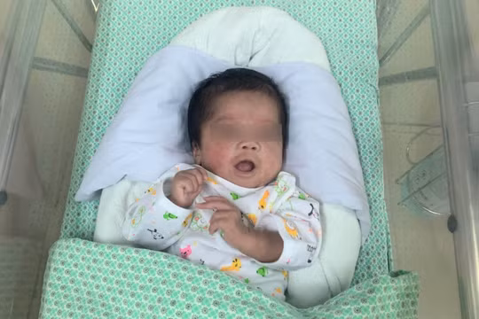 Thai nhi sinh non 31 tuần tuổi bị ngừng tim, ngừng thở đã hồi phục (Ảnh: Nguyễn Liên) 