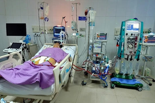 Các bác sĩ ở Bệnh viện Đa khoa tỉnh Sóc Trăng sử dụng ECMO để cứu sống bệnh nhân H. (Ảnh - BVCC)