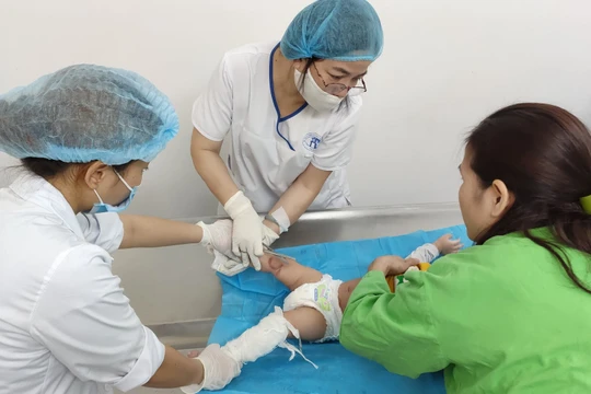 Bác sĩ chăm sóc cho bé bị bỏng nước sôi (Ảnh: Bệnh viện Đa khoa Xanh Pôn) 