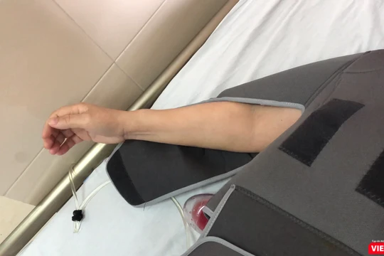 Cánh tay của cô Th. hồi phục sau khi được thay xương bả vai (Ảnh: bác sĩ Phạm Sơn Tùng)