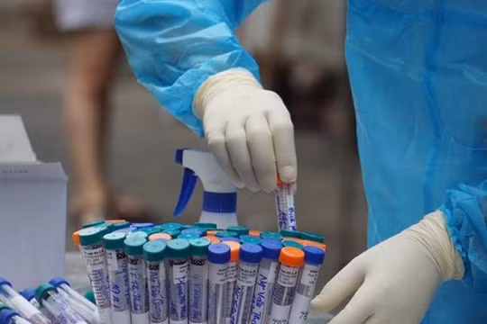 Đẩy nhanh tốc độ xét nghiệm COVID-19 để khoanh vùng dịch bệnh (Ảnh: Báo Chính phủ) 