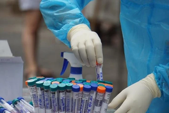 Đẩy nhanh tốc độ xét nghiệm COVID-19 để khoanh vùng dịch bệnh (Ảnh: Báo Chính phủ) 