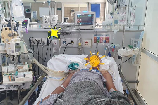 Bệnh nhân Đỗ Văn Ch. (46 tuổi, ở Tĩnh Gia, Thanh Hóa) nhập viện vào BV Bạch Mai trong tình trạng đã ngừng tim, hiện vẫn hôn mê sâu (Ảnh: BVCC) 