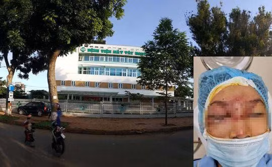 Bé trai 14 tuổi được cấp cứu ở Bệnh viện Mắt Tây Nguyên