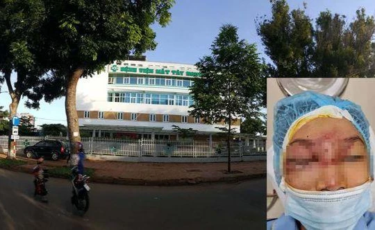 Bé trai 14 tuổi được cấp cứu ở Bệnh viện Mắt Tây Nguyên