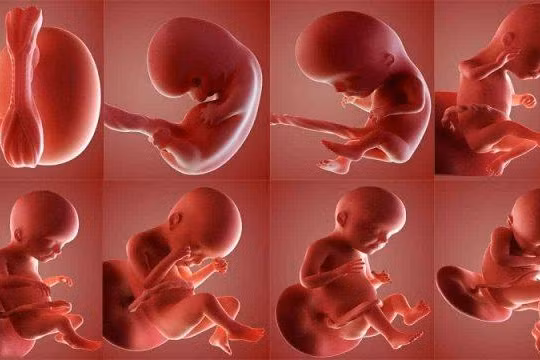 Nguyên nhân gây nên dị tật bẩm sinh hiếm gặp ở trẻ em