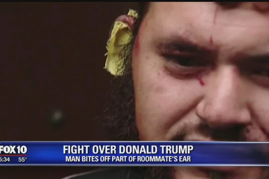 Tranh luận về Tổng thống Trump, một người Mỹ bị cắn đứt tai