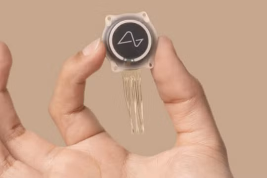 Thiết bị cấy ghép não của Neuralink (Ảnh:Bloomberg)