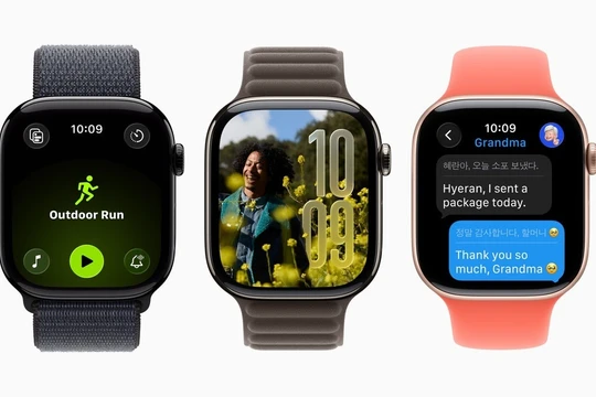 watchOS 26 trên Apple Watch. Ảnh: Apple