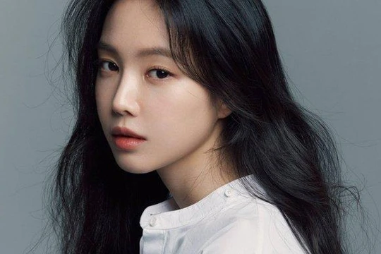 Son Naeun là gương mặt visual của nhóm Apink