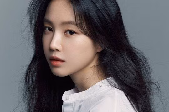 Son Naeun là gương mặt visual của nhóm Apink