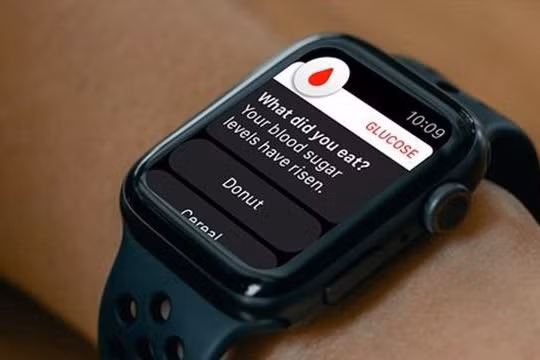 FDA cảnh báo không sử dụng đồng hồ thông minh đo đường huyết