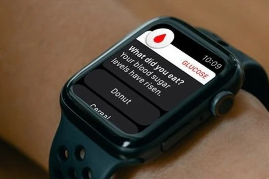 FDA cảnh báo không sử dụng đồng hồ thông minh đo đường huyết